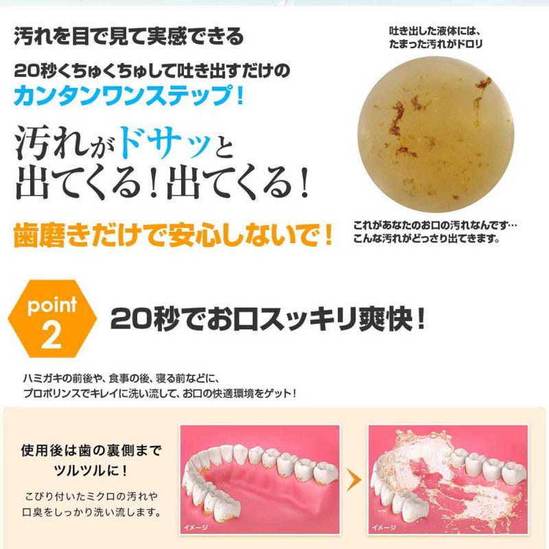 Alternative view of プロポリンスリフレッシュ　（１５０ｍｌ）